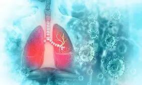 ذات الریه مرگبار با منشا ناشناخته در آرژانتین