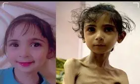 سومین نوزاد گرسنهٔ غزه در ۲۴ ساعت گذشته به شهادت رسید

