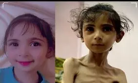 سومین نوزاد گرسنهٔ غزه در ۲۴ ساعت گذشته به شهادت رسید

