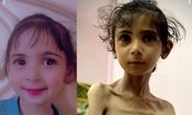 سومین نوزاد گرسنهٔ غزه در ۲۴ ساعت گذشته به شهادت رسید

