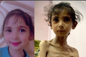 سومین نوزاد گرسنهٔ غزه در ۲۴ ساعت گذشته به شهادت رسید

