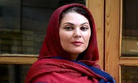 تغییر چهره لاله اسکندری بعد از عمل زیبایی/ ویدئو