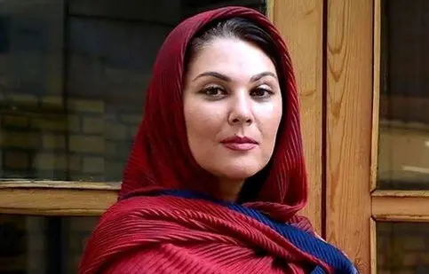 تغییر چهره لاله اسکندری بعد از عمل زیبایی/ ویدئو