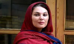 تغییر چهره لاله اسکندری بعد از عمل زیبایی/ ویدئو