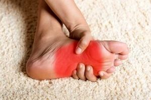 داغی و سوزش کف پا نشانه چیست؟