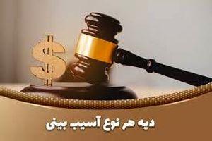  دیه مُشت‌ زدن و شکستن بینی چقدر است؟/ ویدئو