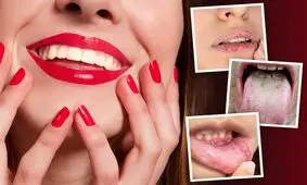 ۵ چیزی که لبخند و بهداشت دهان شما در مورد سلامتی‌تان به شما می‌گوید