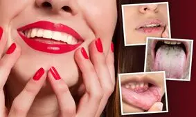 ۵ چیزی که لبخند و بهداشت دهان شما در مورد سلامتی‌تان به شما می‌گوید