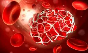 آیا بیماری هموفیلی قابل درمان است؟