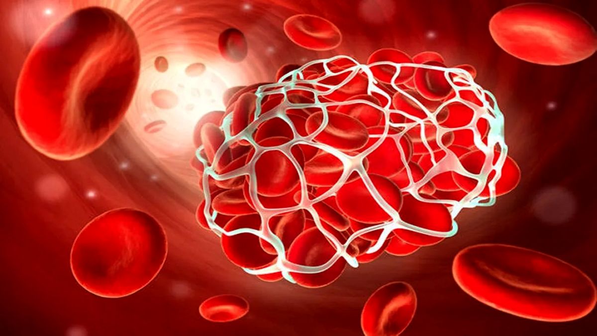 آیا بیماری هموفیلی قابل درمان است؟