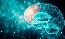 زیرنویس مغزی؛ دانشمندان راهی برای تبدیل افکار به متن با اسکن MRI پیدا کردند