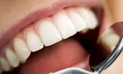 ارتباط بیماری های دهان با بروز برخی سرطان ها