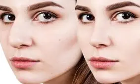 اهمیت پزشک خوب در میزان موفقیت عمل بینی