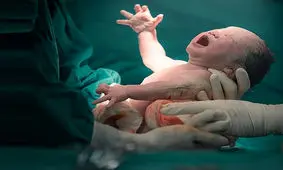 سزارین یا طبیعی؛ نعل وارونه وزارت بهداشت بر سلامت مادر و نوزاد