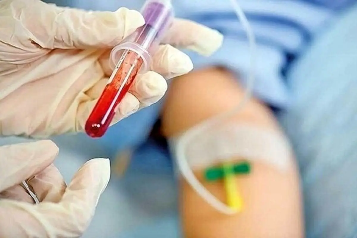 پیشگیری از هموفیلی امکان پذیر است؟