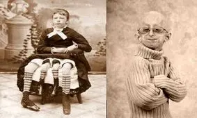 اگر خداوند عادل است، توجیه افراد ناقص‌الخلقه چیست؟

