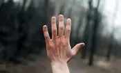 چرا انسان‌ها در هر دست‌ و پای خود ۵ انگشت دارند؟ 