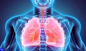 عامل اصلی مرگ و میر ناشی از سرطان در جهان