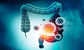 سرطان روده به زیر ۴۰ سال رسید