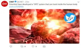 جی‌پی‌اس داخل بدن تومورها را پیدا می‌کند