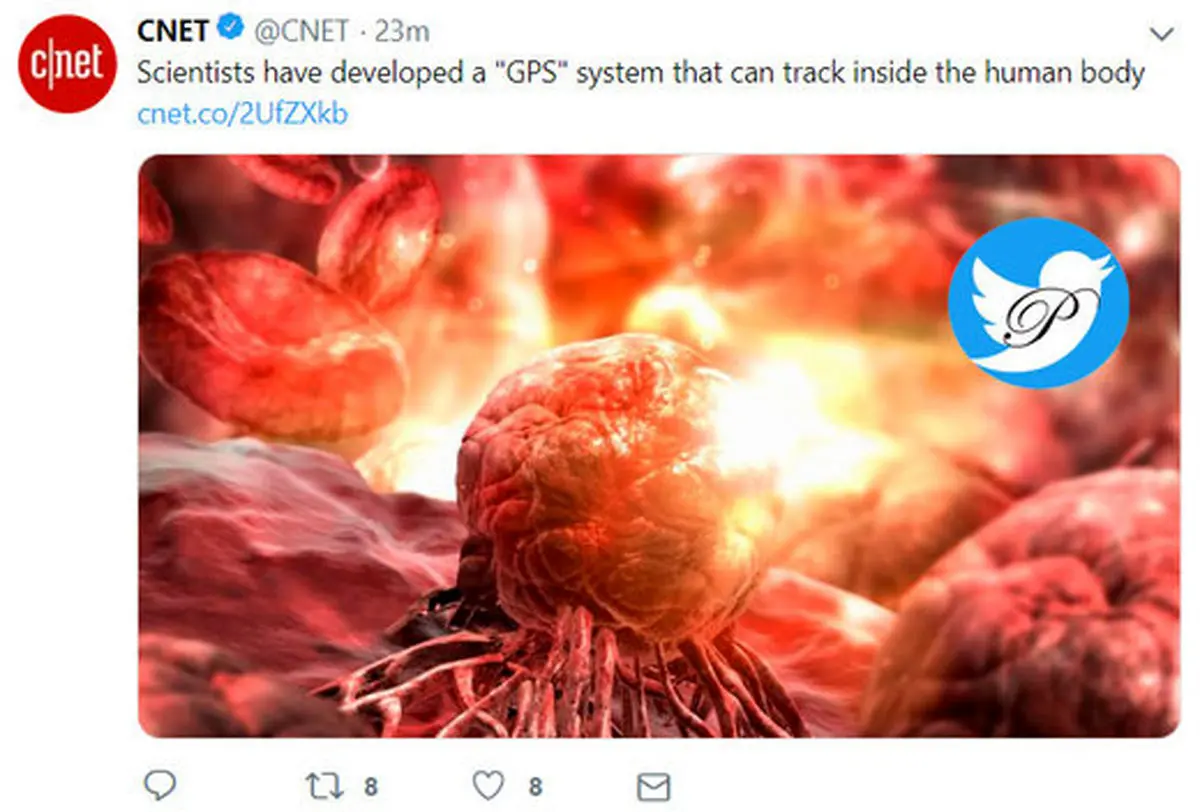 جی‌پی‌اس داخل بدن تومورها را پیدا می‌کند