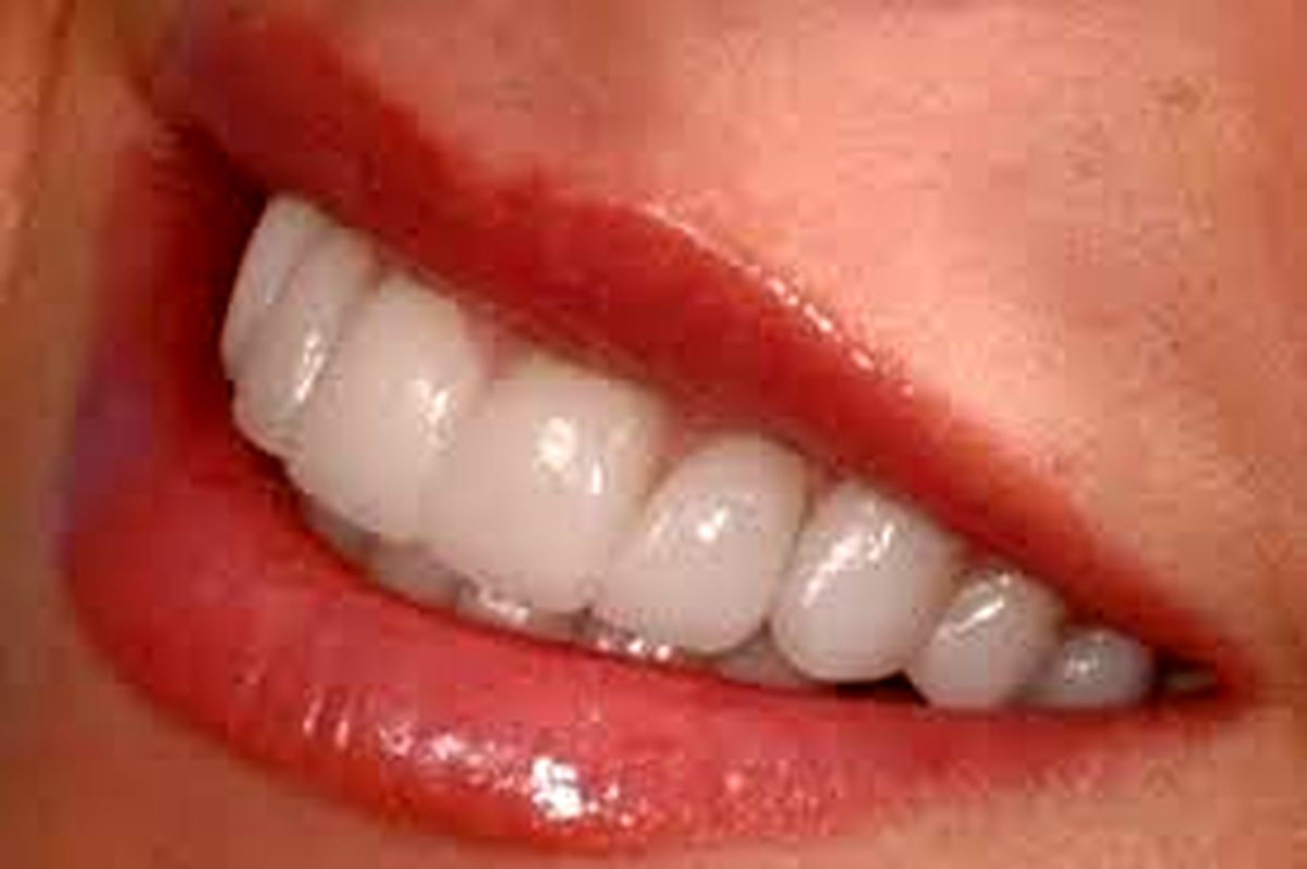 سلامت دندانها را با یک ماده خانگی بیمه کنید
