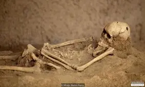 راز جمجمه های سوراخ شده در دوران باستان چیست؟ + تصاویر