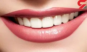 خشکی لب را با درمان های خانگی رفع کنید