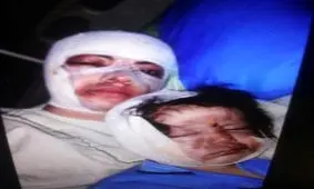 اسید پاشی روی «نرگس» و «شیما» +عکس