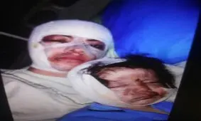 اسید پاشی روی «نرگس» و «شیما» +عکس