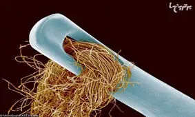 منظره عجیب و باورنکردنی چیزهای عادی زیر میکروسکوپ!