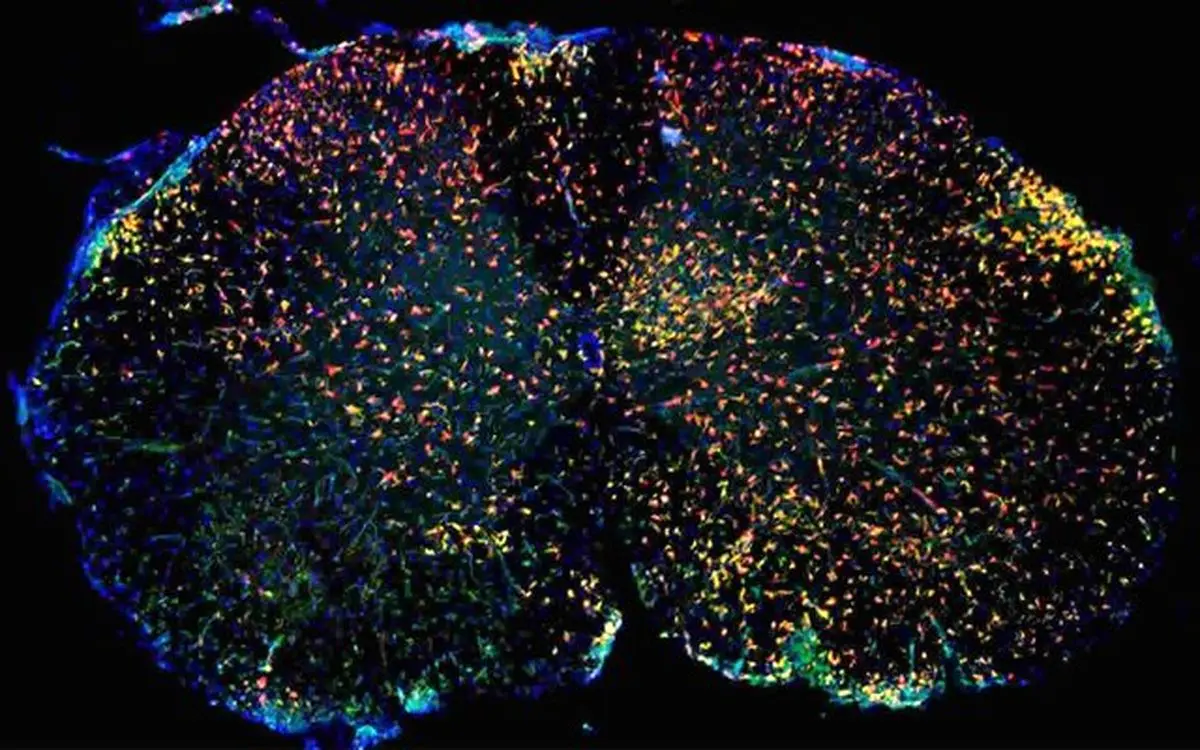 نوع جدیدی از سلول‌های ایمنی عامل بیماری ام‌.اس هستند