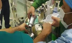 گیر کردن دست کودک در چرخ گوشت حادثه آفرید