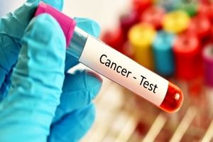 تشخیص بهتر سرطان با کمک زنی که از ۱۲ تومور جان سالم به در برد

