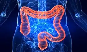 بیماری التهاب روده ریسک مرگ را افزایش می دهد