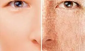 با این ترفندها پوستتان را نرم و مرطوب کنید