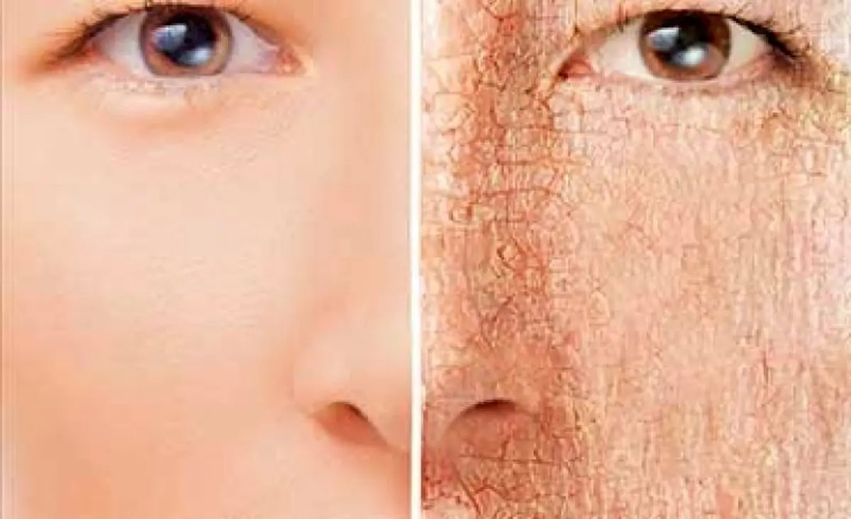 با این ترفندها پوستتان را نرم و مرطوب کنید