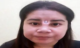 عاقبت وحشتناک این دختر برای عمل زیبایی