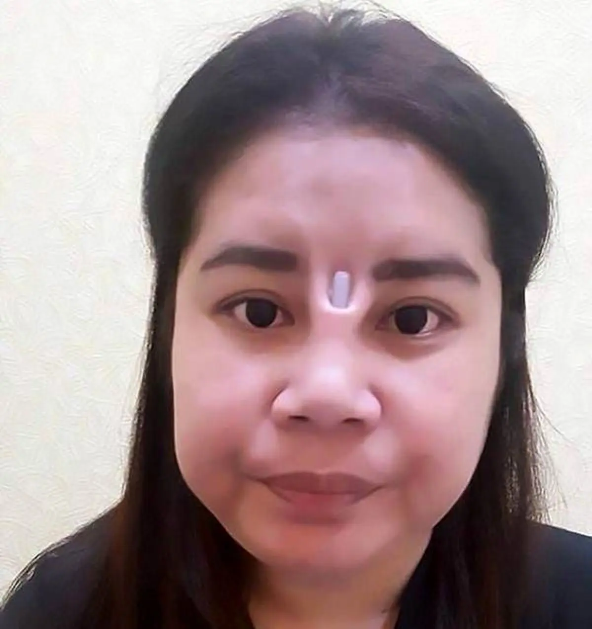 عاقبت وحشتناک این دختر برای عمل زیبایی