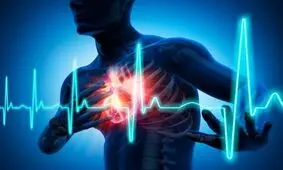 آمار ۴۶ درصدی مرگ قلبی در ایران/ اهمیت آنژیوپلاستی