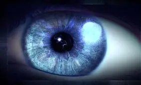 علائم آب مروارید چیست؟