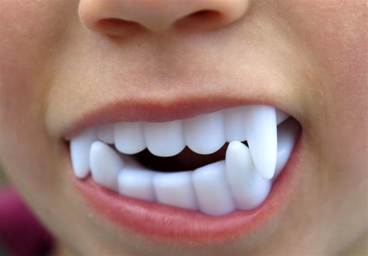 دندان شیشه‌ای دراکولا، کودک ۵ ساله را روانه بیمارستان کرد