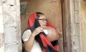 زندگی غم انگیز مادر جوان با تومور بزرگ زیر فکش + تصاویر