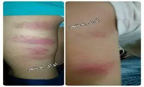 ویدئو و تصاویر تنبیه بدنی دانش آموزان با کابل