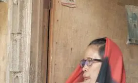 بیماری وحشتناکی که زندگی زن نگون‌بخت را سیاه کرد +تصاویر