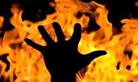 پدری، پسرش را به آتش کشید + عکس