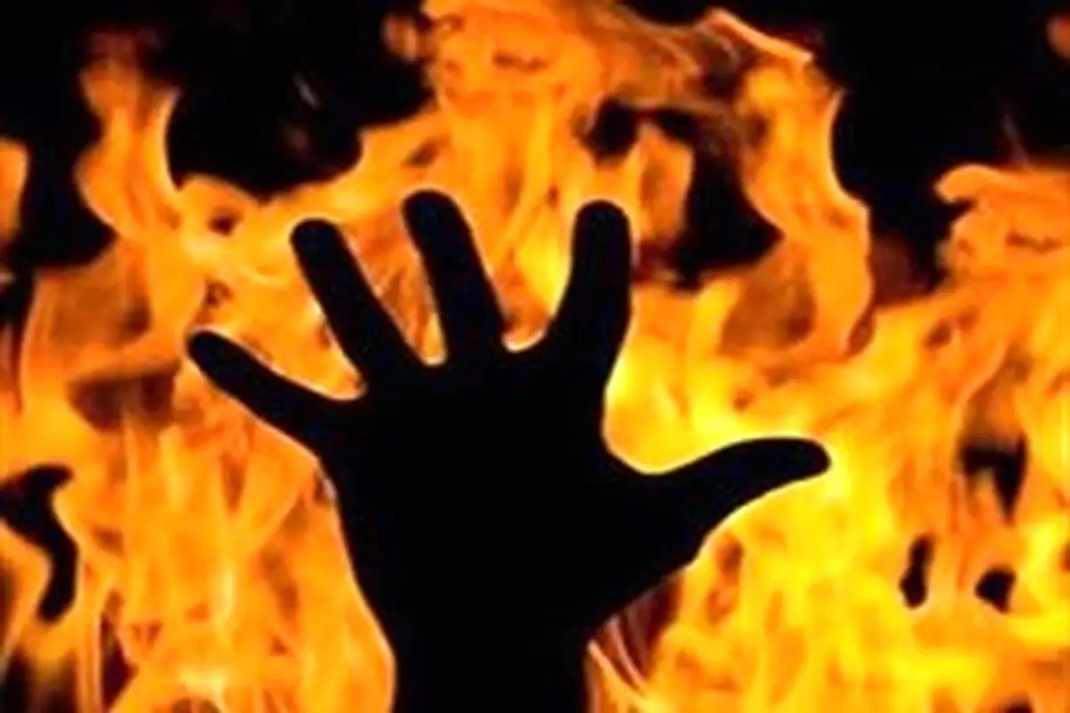 پدری، پسرش را به آتش کشید + عکس