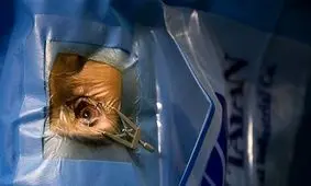 درمان بیماری‌های چشم در ایران همپای اروپا و آمریکا