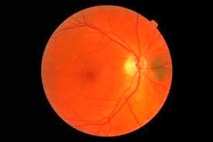 روش جدیدی برای محافظت از شبکیه چشم