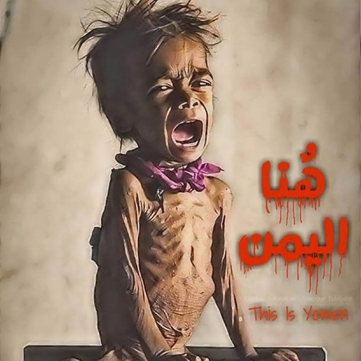 نیویورک تایمز: به زجر یمن پایان دهید